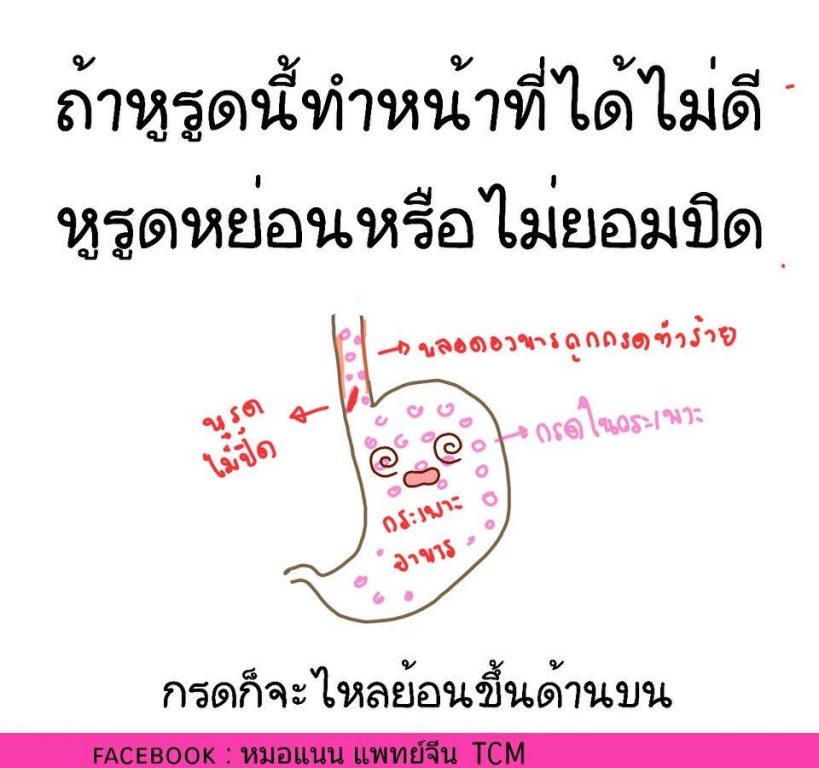 กรดไหลย้อน-8