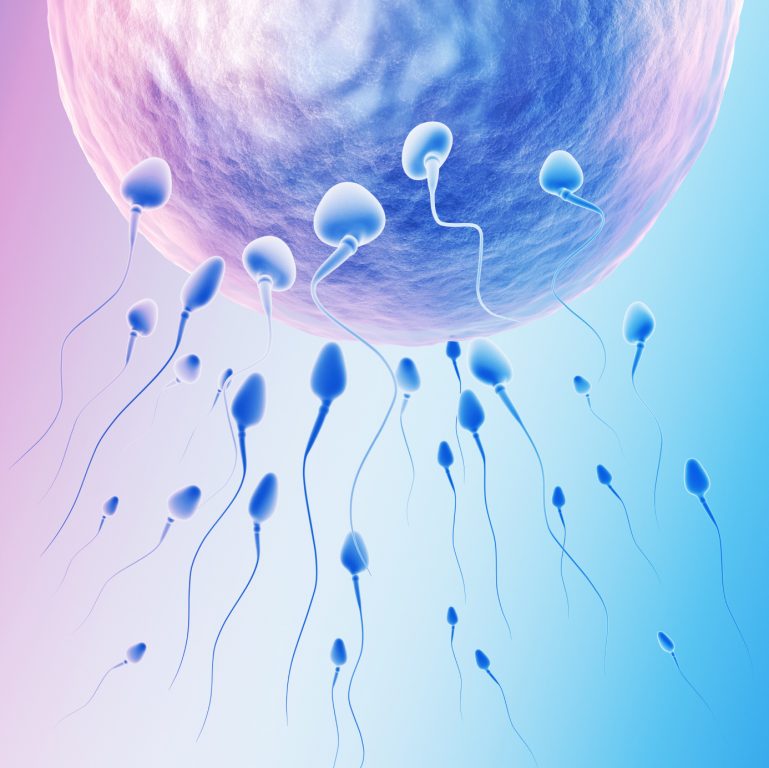Intra-uterine insemination-2