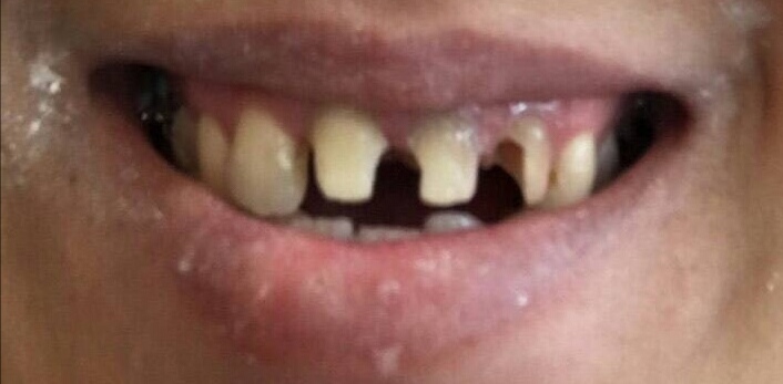 ฟัน-3