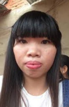 ศัลยกรรม7