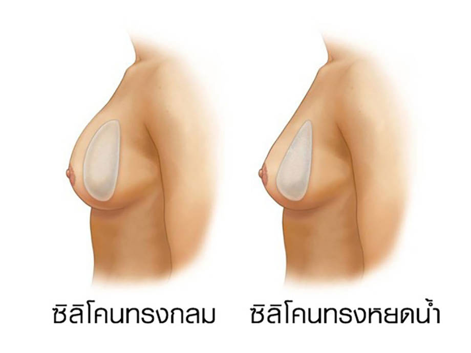หน้าอก-11