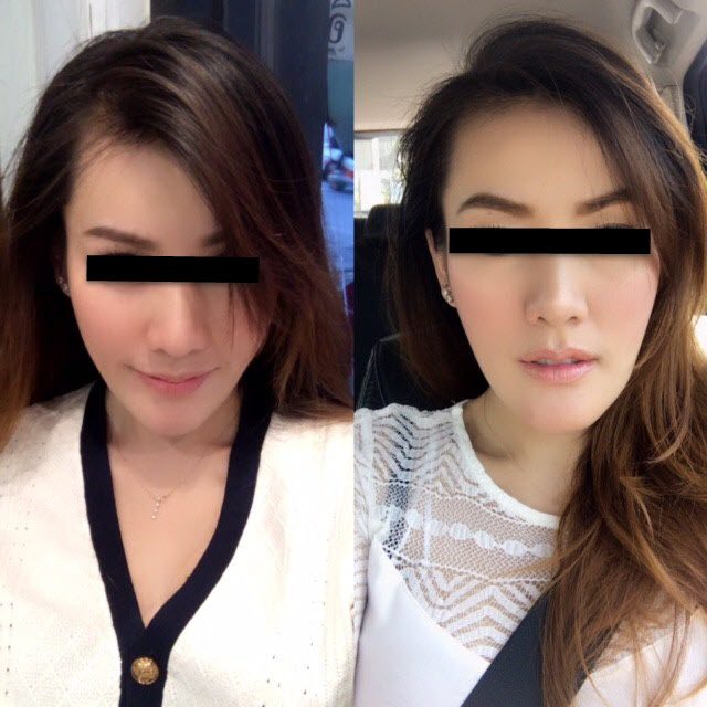 ศัลยกรรม-11
