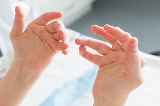 Hands of a woman with rheumatoid arthritis.