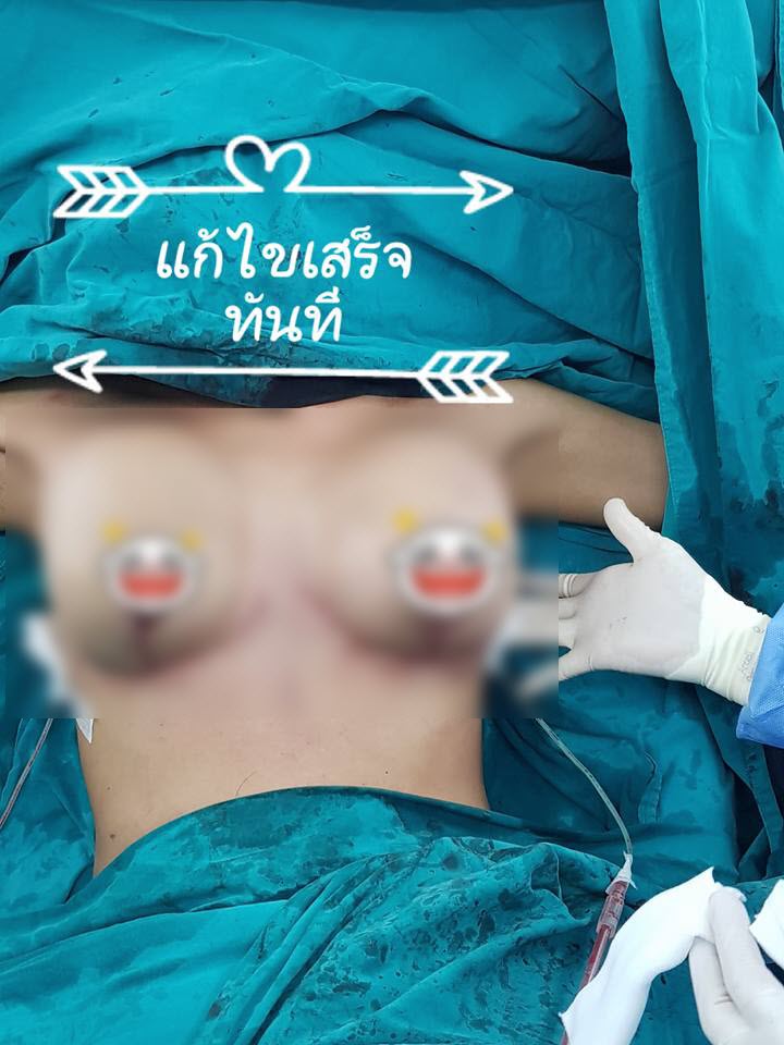 หน้าอก-2