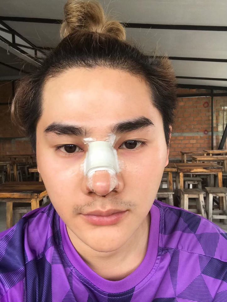 ศัลยกรรม-5